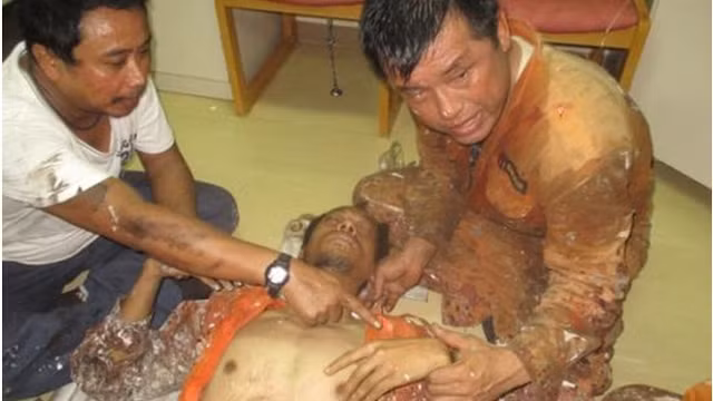 利比里亚籍货轮YM COSMOS病危的船员。