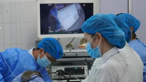 越南九龙江三角洲地区首次开展超声内镜技术。（图片来源：芹苴中央综合医院）
